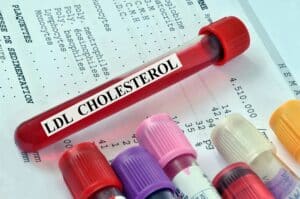 Voici ce que votre taux de cholestérol révèle sur votre risque de démence